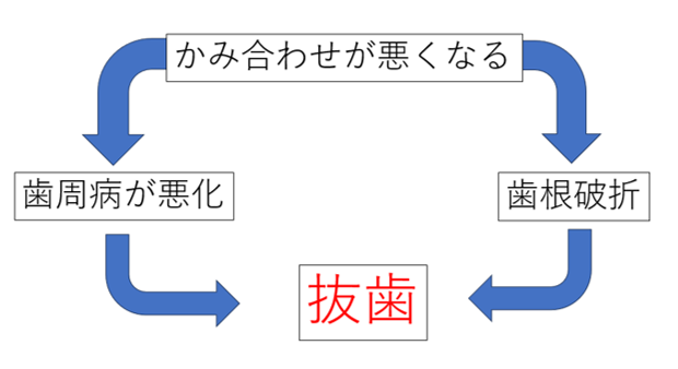 噛み合わせ